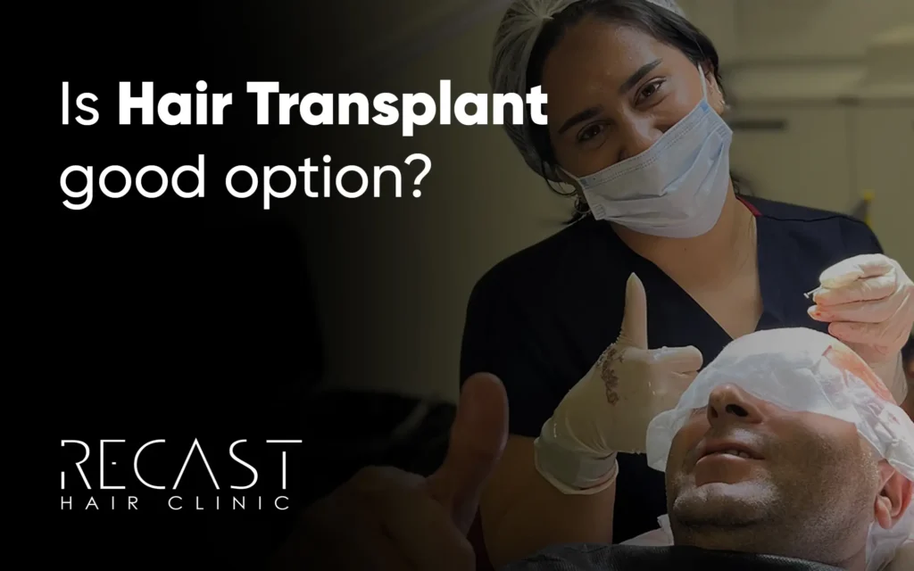 Is hair transplant a good option?