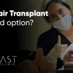 Is hair transplant a good option?