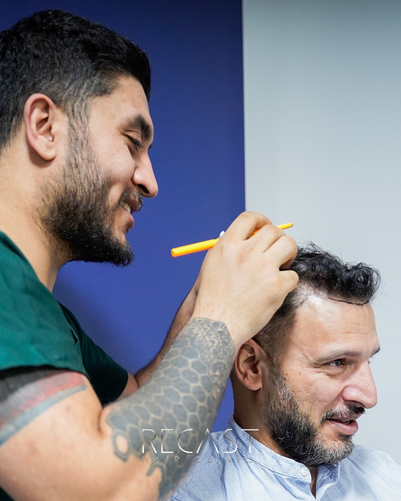 High Density Hair Transplant