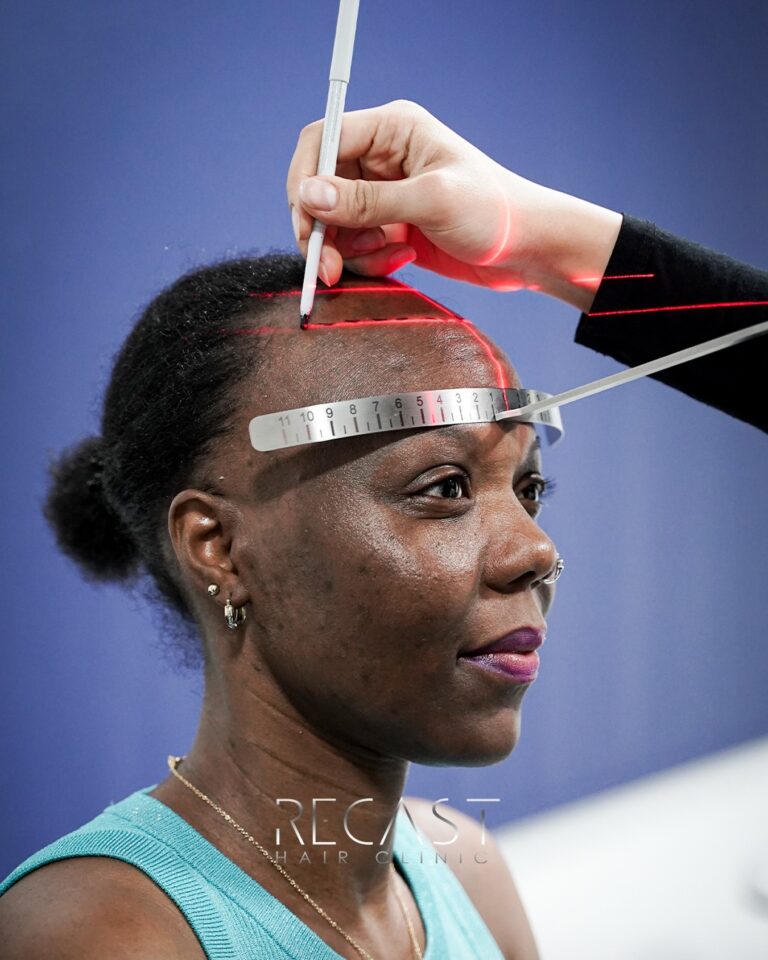 Digital Hair Analysis