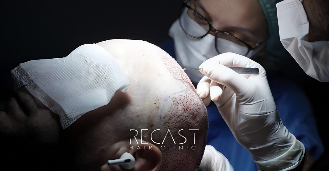 Treatments - Hair Transplantation Clinic