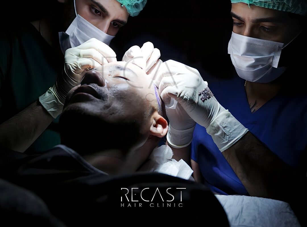 Hair Clinic - Recast Hair Clinic Team