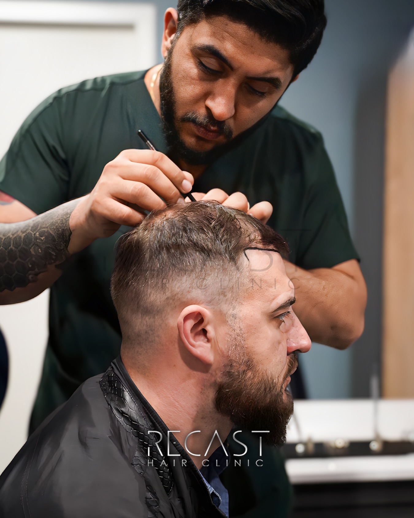 Sapphire FUE Hair Transplant